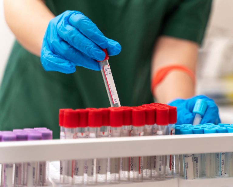 Exámenes de Hematología